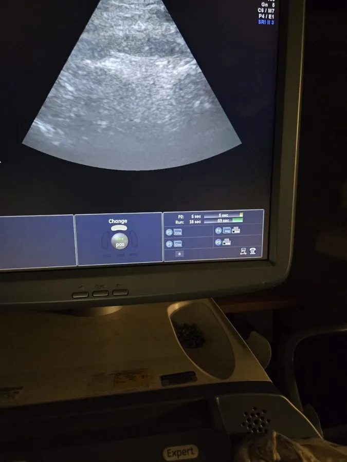 УЗИ-датчик GE PA6-8-D Ultrasound Probe / Transducer — фото лота 1