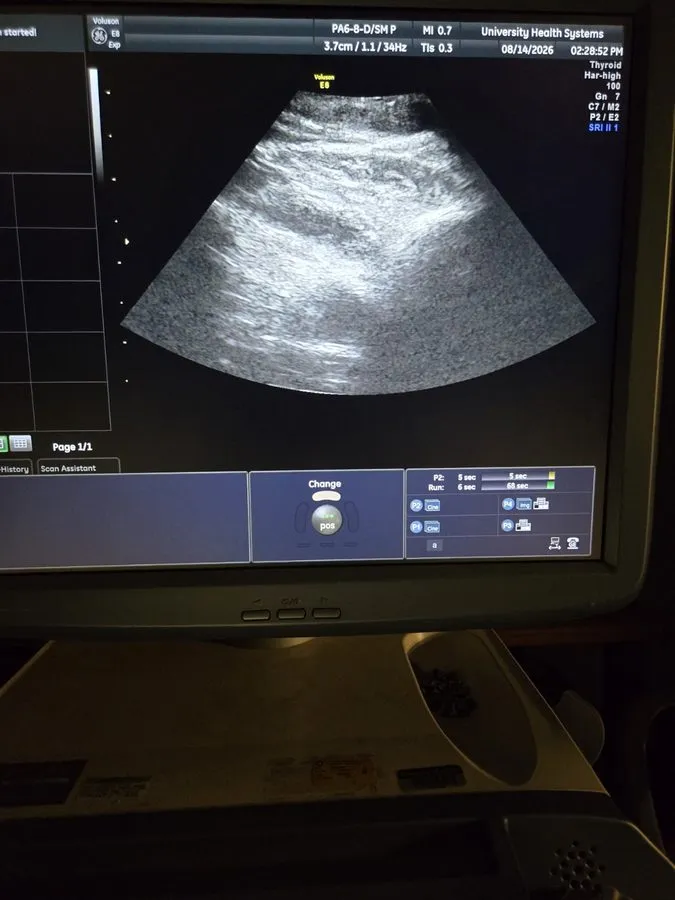 УЗИ-датчик GE PA6-8-D Ultrasound Probe / Transducer — фото лота 2