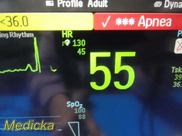 Монитор пациента Philips IntelliVue MP30 Touch Patient Monitor w/ M3001A & M3015