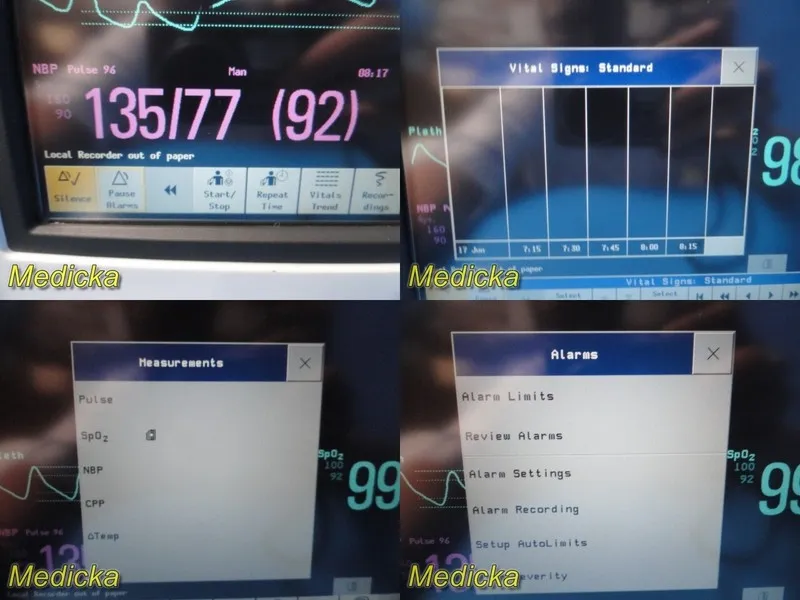 Монитор пациента 2011 Philips MP5T M8105AT Multiparameter Patient Monitor W/ Lea — фото лота 2