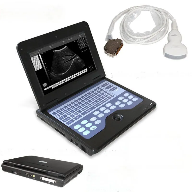 УЗИ-аппарат SR600P2 Portable Ultrasound Scanner Ultrasound Machine Convex probe 