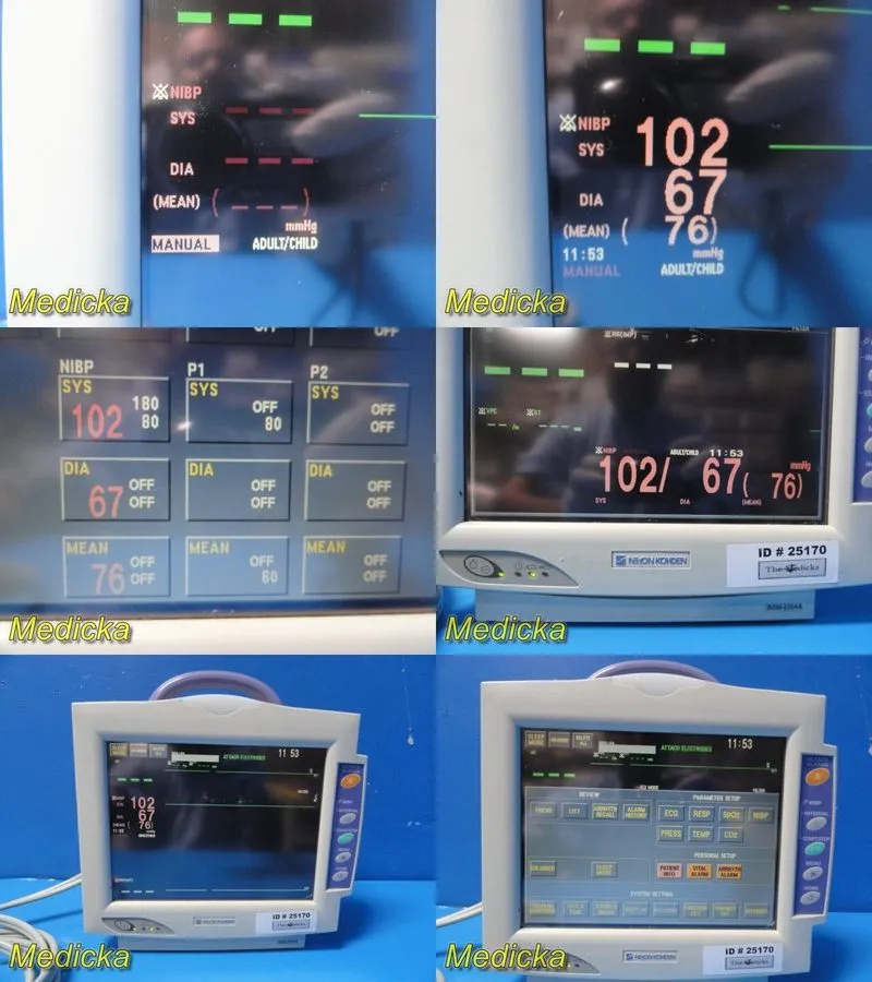 Монитор пациента GCX Polymount Nihon Kohden (BSM-2354A) Patient Monitor Stand W/