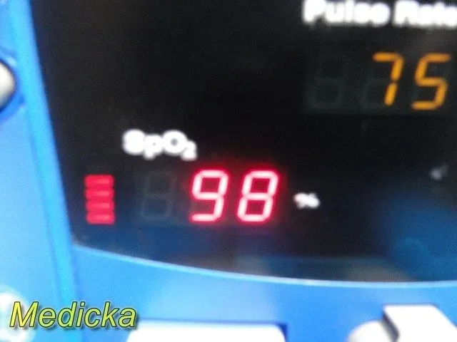 Монитор пациента GE Carescape V100 Vital Signs Monitor (V100-NBAA-AXAA-BX) W/ Le — фото лота 2