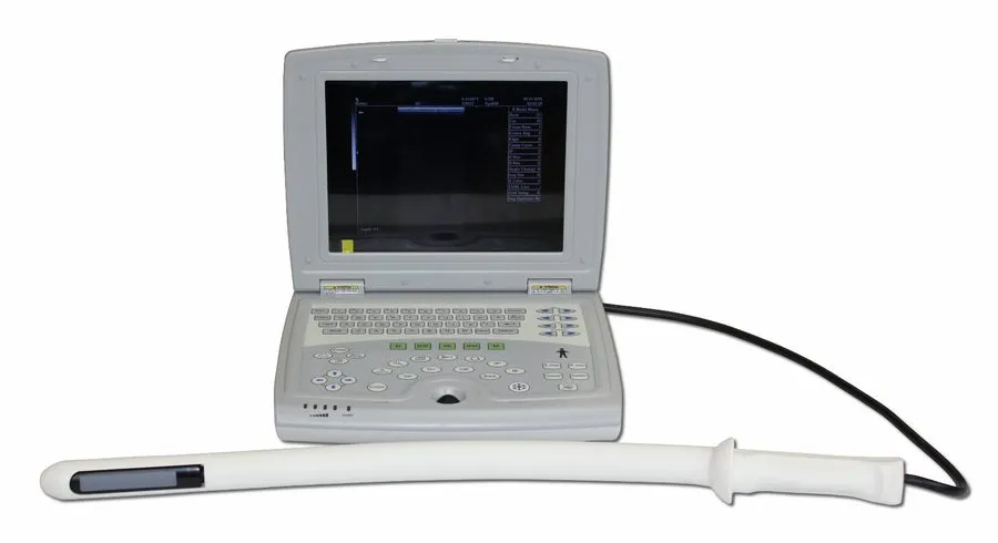 УЗИ-аппарат KX5000V Veterinary Laptop Bovine Equine Ultrasound & Rectal Probe, I — фото лота 1