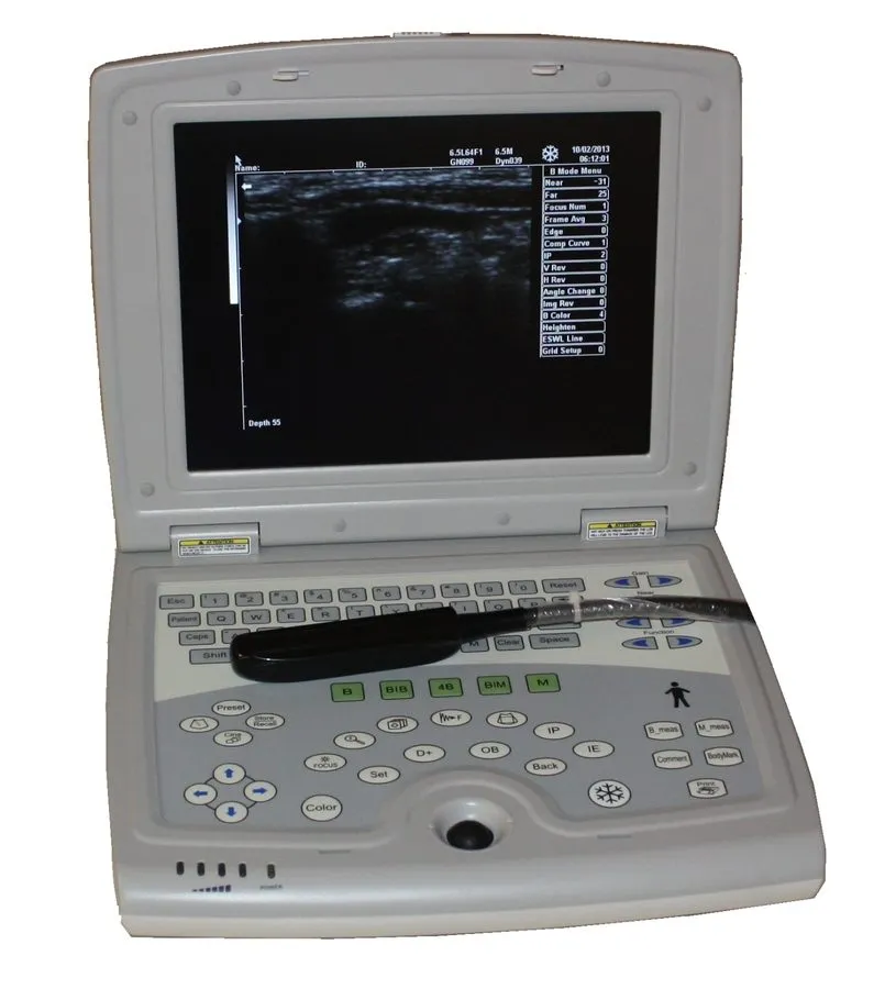 УЗИ-аппарат KX5000V Veterinary Laptop Bovine Equine Ultrasound & Rectal Probe, I — фото лота 2