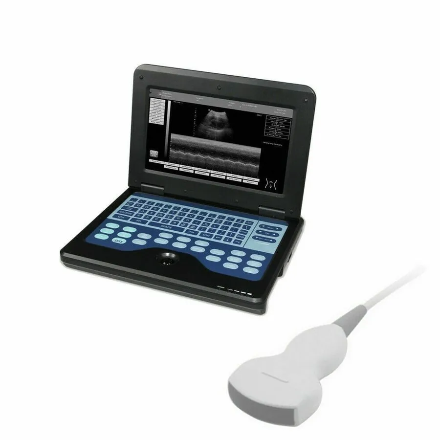 УЗИ-аппарат SR600P2 Portable Ultrasound Scanner Ultrasound Machine Convex probe 