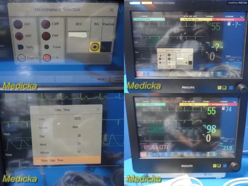 Монитор пациента 2016 Philips IntelliVue MX700 Anesthesia Monitor W/ X2 & M3012A