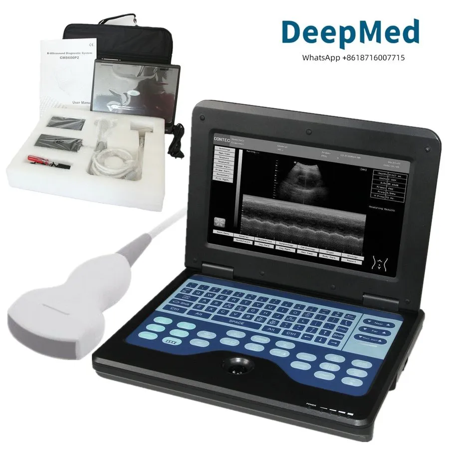 УЗИ-аппарат SR600P2 Portable Ultrasound Scanner Ultrasound Machine Convex probe 