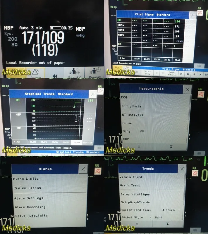 Монитор пациента Philips IntelliVue MP5 Patient Monitor M8001A Vital Signs Touch