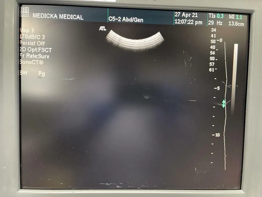 УЗИ-датчик ATL C5-2 40R Convex Curved Array Ultrasound Probe P/N 4000-0574-05(E1 — фото лота 1