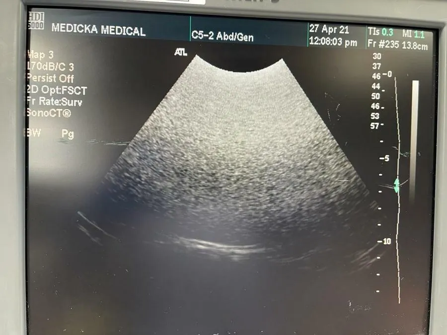 УЗИ-датчик ATL C5-2 40R Convex Curved Array Ultrasound Probe P/N 4000-0574-05(E1 — фото лота 2