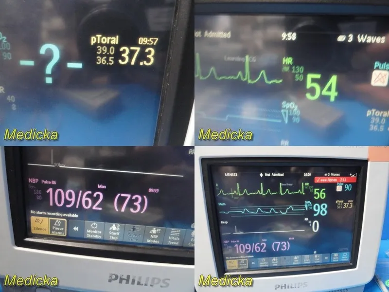 Монитор пациента 2009 Philips MP5 865024 (M8105A) Multi-parameter Monitor W/ Lea