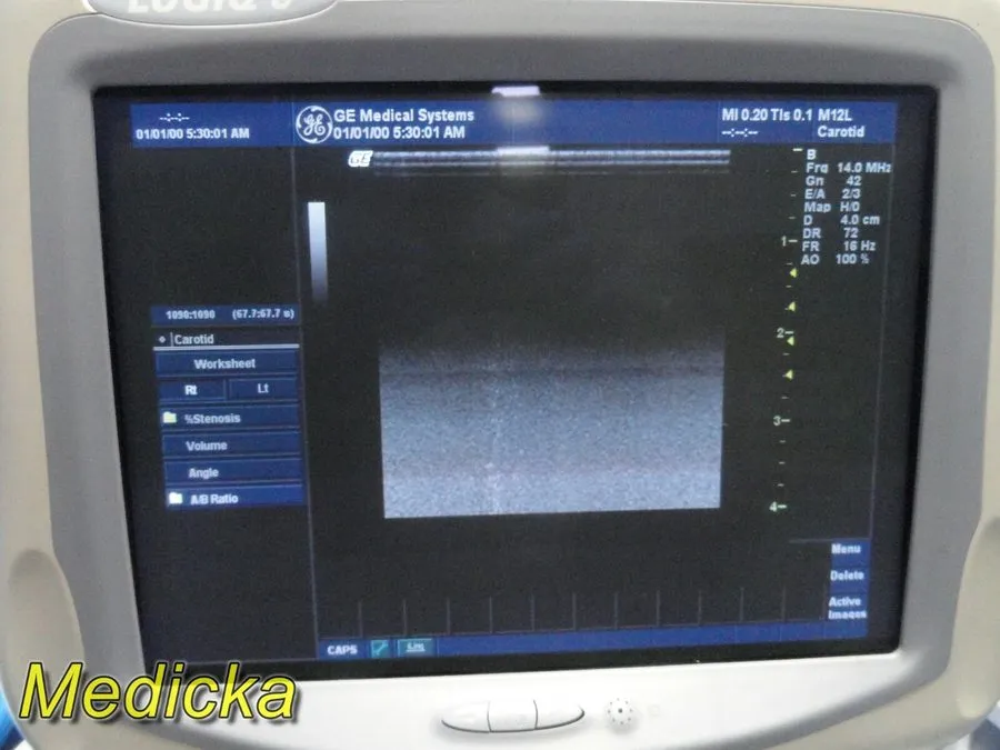 УЗИ-датчик GE M12L Linear Array Ultrasound Transducer Probe 19426