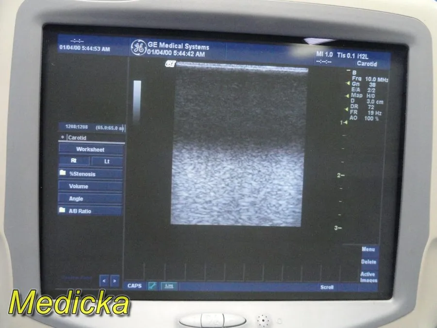 УЗИ-датчик 2010 GE 2664882 / i12L Linear Array Intraoperative Ultrasound Transdu — фото лота 2
