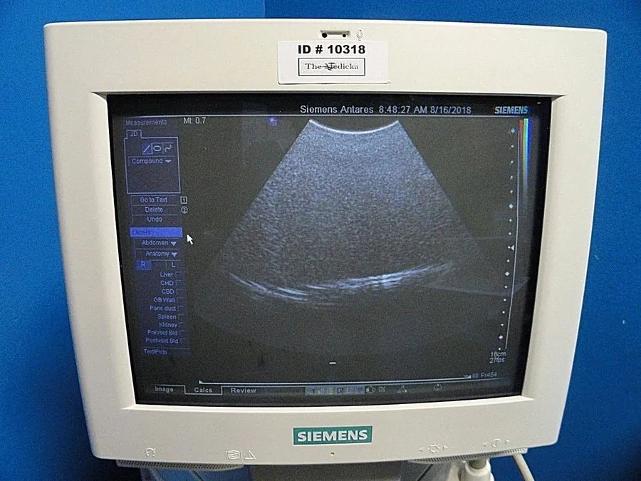 УЗИ-датчик SIEMENS Antares CH6-2 P/N 7465672 Convex Array Ultrasound Transducer  — фото лота 2