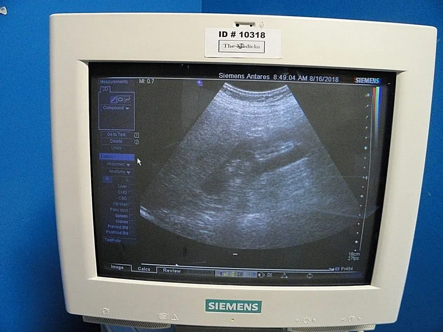 УЗИ-датчик SIEMENS Antares CH6-2 P/N 7465672 Convex Array Ultrasound Transducer  — фото лота 3