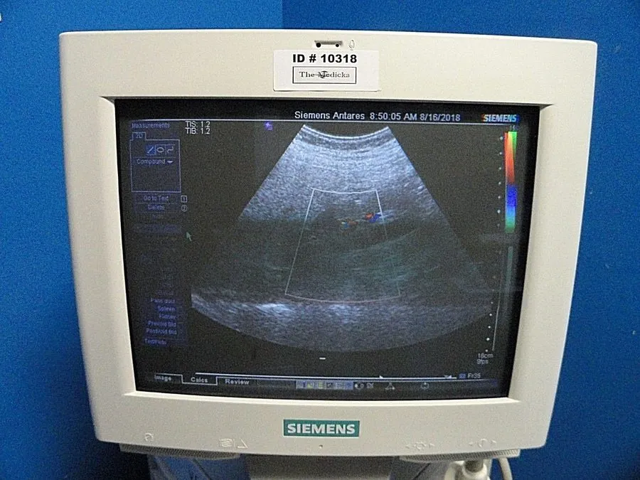 УЗИ-датчик SIEMENS Antares CH6-2 P/N 7465672 Convex Array Ultrasound Transducer  — фото лота 4