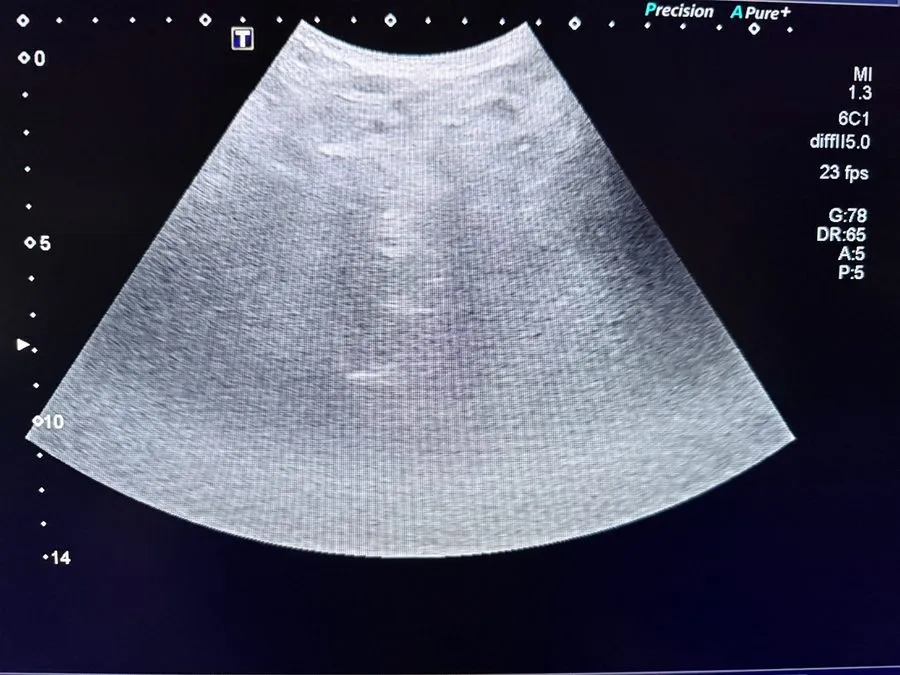УЗИ-датчик Toshiba PVT-375BT ( 6C1 ) convex array ultrasound transducer — фото лота 2