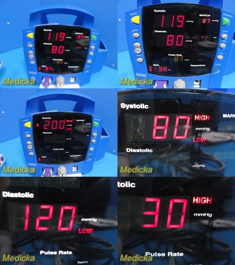 Блок питания GE Dinamap DPC 420N-EN Procare Monitor W/ SpO2/NBP Leads,Power Supp — фото лота 1