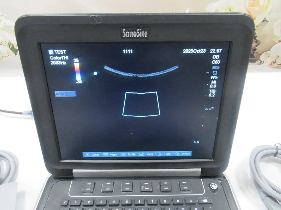 УЗИ-аппарат SONOSITE EDGE ULTRASOUND HFL38x LINEAR+L25x+C60x CURVED+P10x PHASED  — фото лота 1