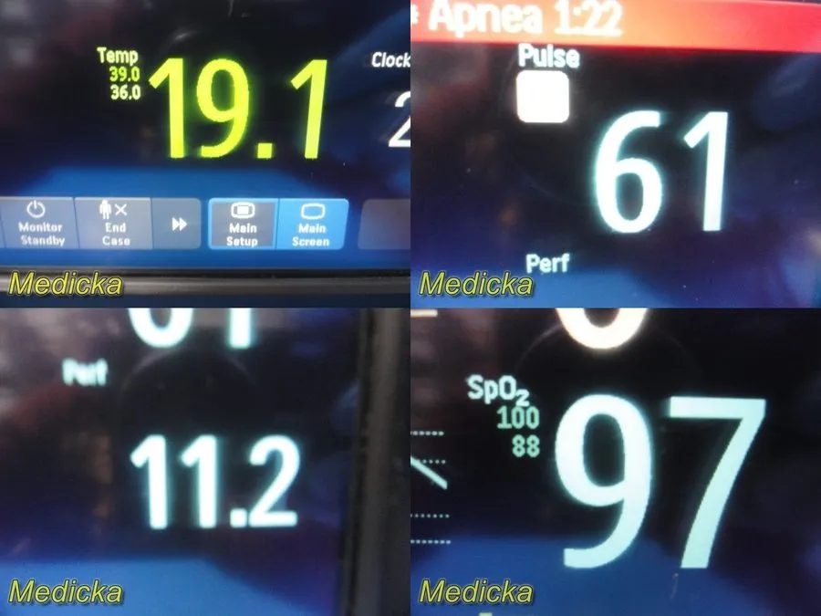 Монитор пациента Philips IntelliVue MP30 Touch Patient Monitor w/ M3001A & M3015