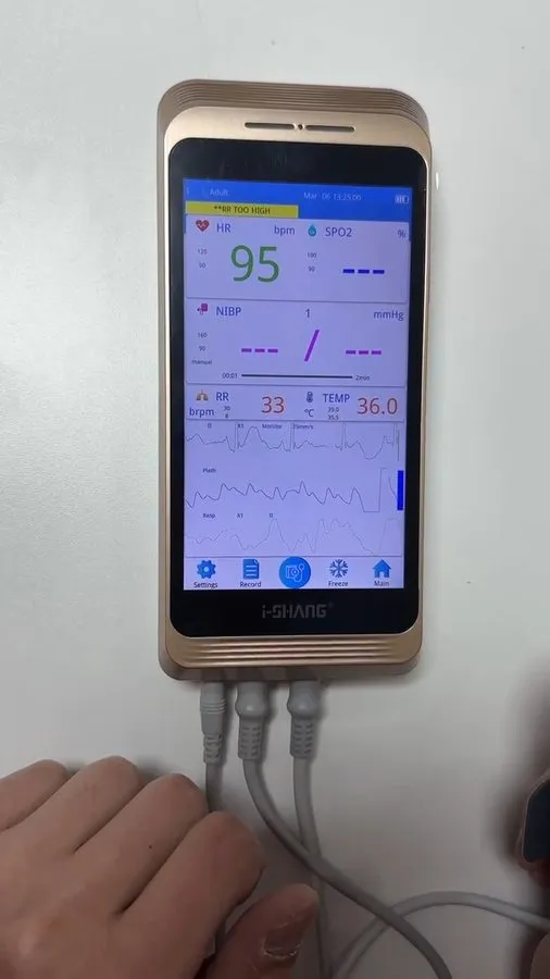Монитор пациента 10" Screen Ultrathin Patient Monitor Portable 6-parameter Vital