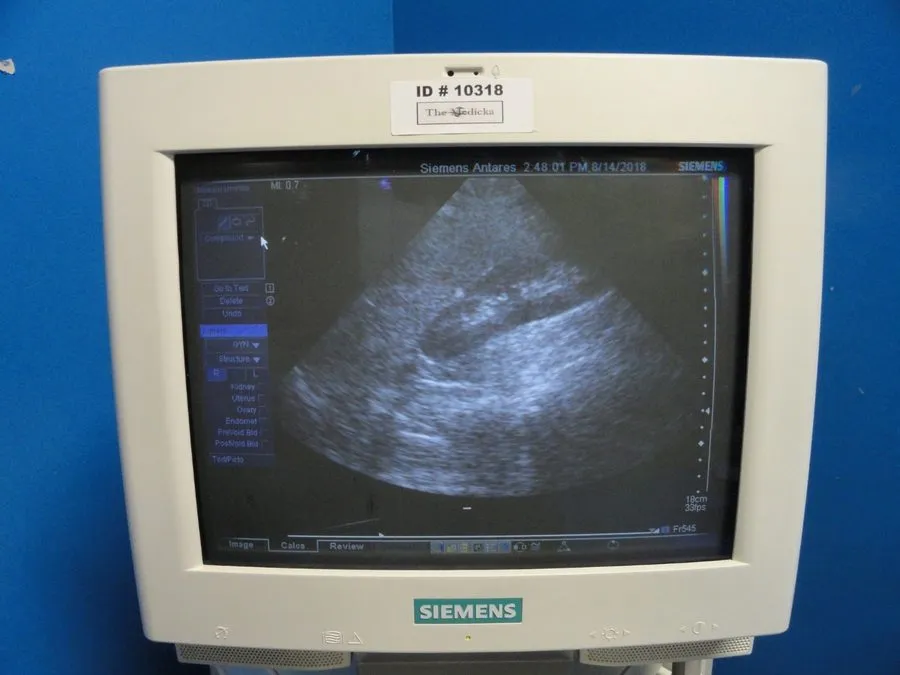 УЗИ-датчик Siemens PH4-1 Model 7466910 Sector Array Ultrasound Transducer Probe  — фото лота 3