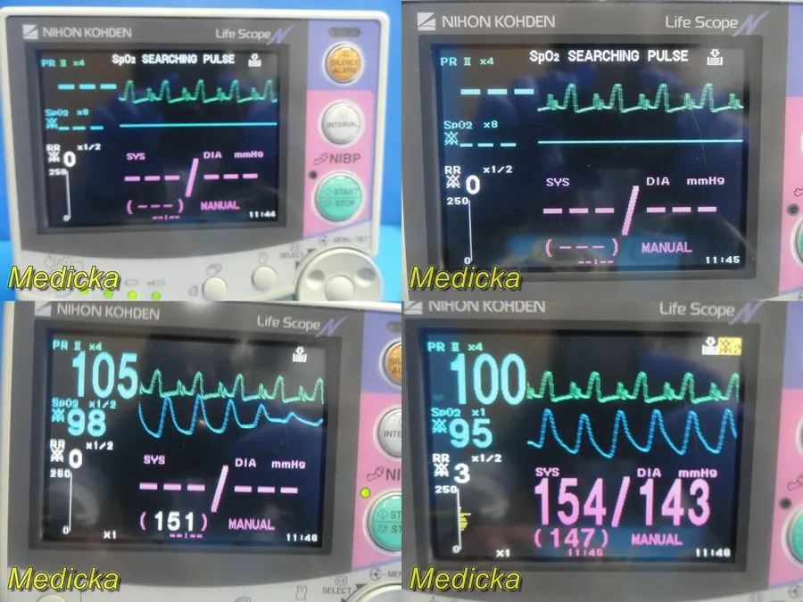 Монитор пациента Nihon Kohden OPV-1500K Life Scope N Bedside Patient Monitor W/ 