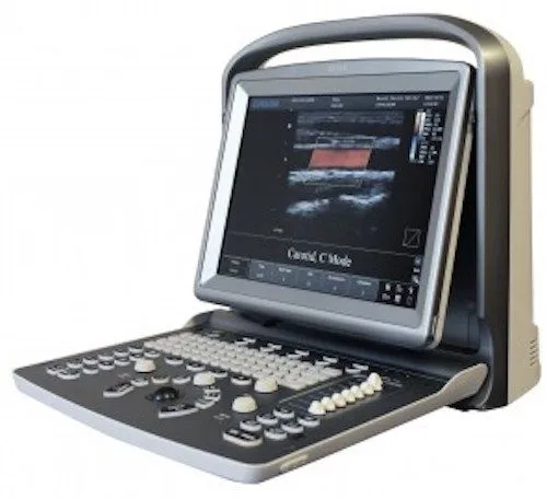 УЗИ-аппарат Demo Model Chison ECO5Vet Portable Ultrasound with One Probe, Active — фото лота 1