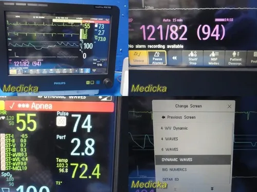 Монитор пациента 2016 Philips IntelliVue MX700 Anesthesia Monitor W/ X2 & M3012A — фото лота 2