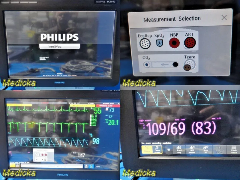Электрокардиограф 2015 Philips IntelliVue MX800 Monitor w/ MMS, M3015A CO2 Dock 