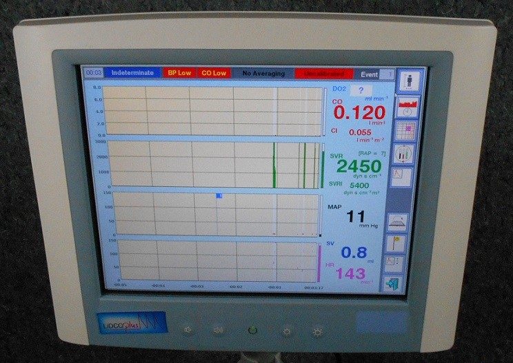 Монитор пациента Lidco HM-71-02 Plus Hemodynamic Touch Screen Monitor with Stand — фото лота 2