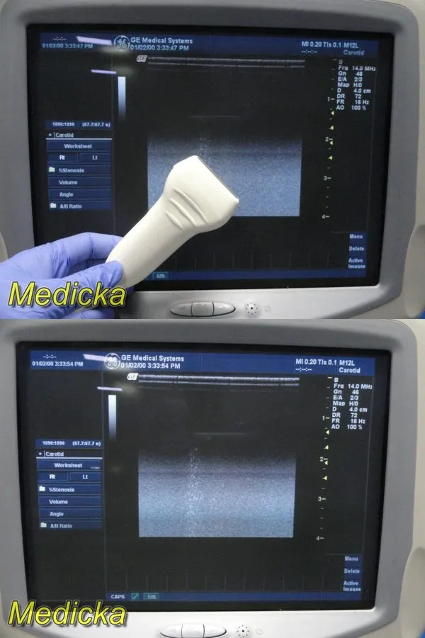 УЗИ-датчик GE M12L Linear Array Ultrasound Transducer Probe 19426