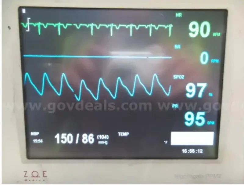 Монитор пациента ZOE Medical Nightingale PPM2 Patient Monitor 179-0001 — фото лота 1
