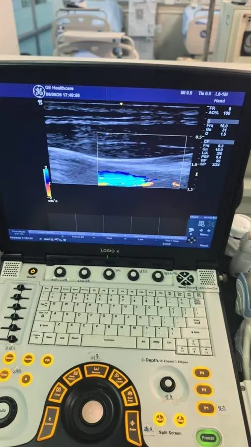 УЗИ-датчик GE L8-18i-RS Ultrasound Probe / Transducer