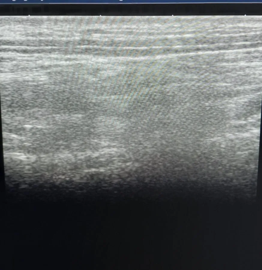 УЗИ-датчик Toshiba PLT-1204BT Linear Array Ultrasound Transducer — фото лота 2